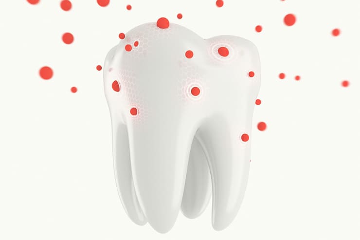 歯質を強化する