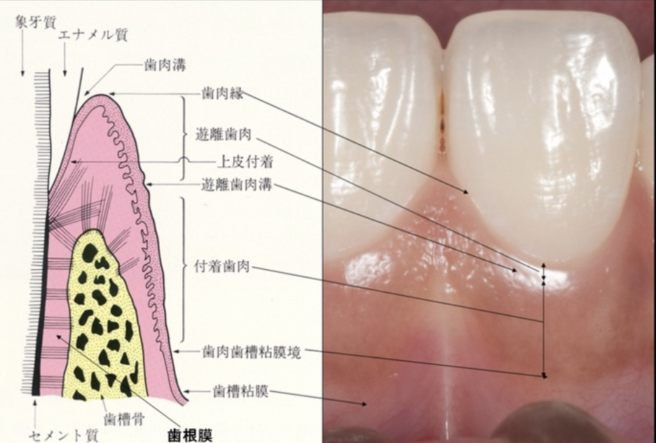 国立　歯医者　歯肉