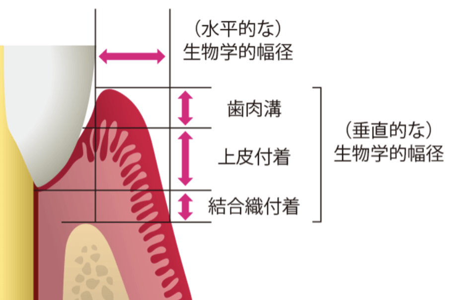 国立　歯医者　生理学的幅径