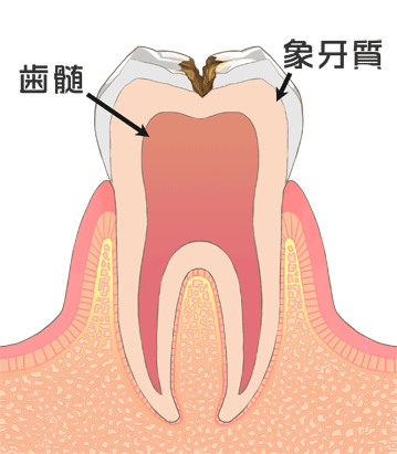 国立　歯医者　C2