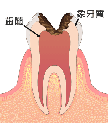 国立　歯医者　C3