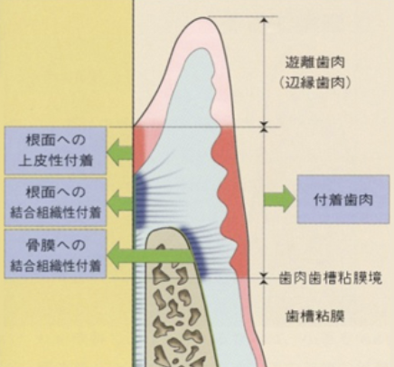 国立　歯医者　付着歯肉