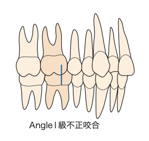 国立　歯医者　Angle