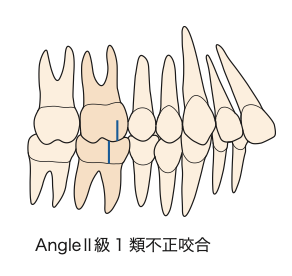 国立　歯医者　Angle