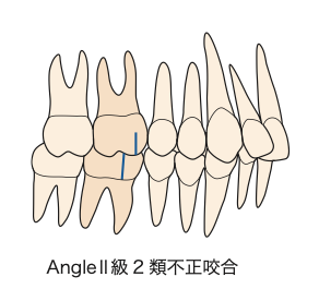 国立　歯医者　Angle