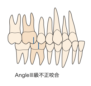 国立　歯医者　Angle