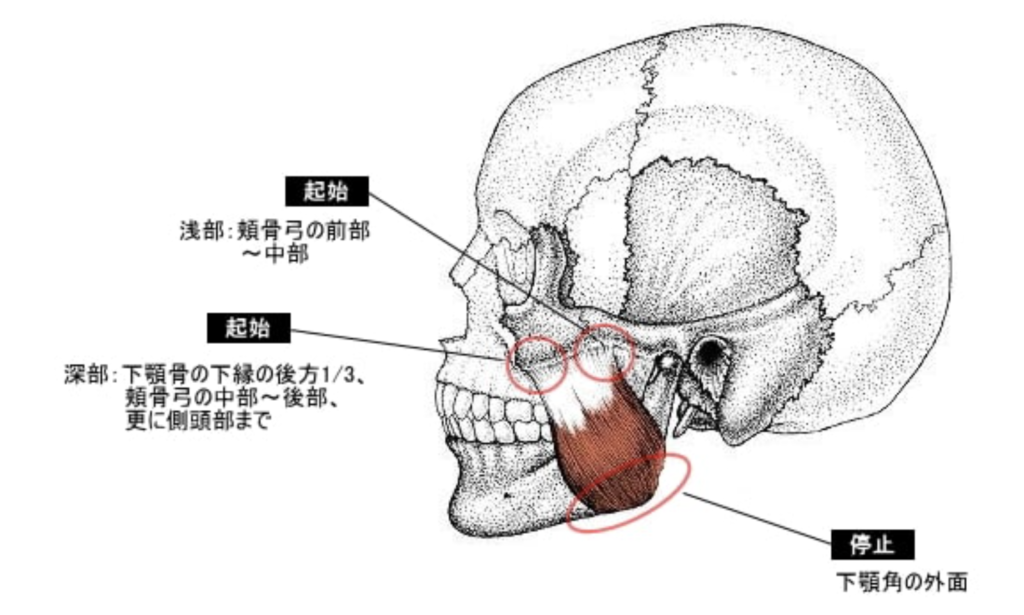 国立　歯医者　咬肉