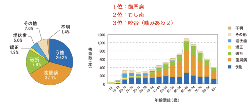 国立　歯医者　歯周病