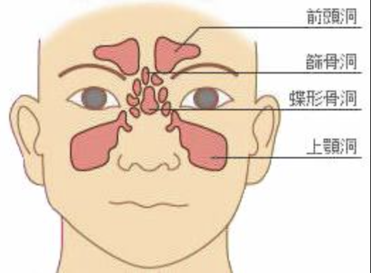 国立　歯医者　副鼻腔