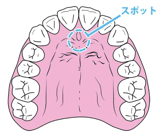 国立　歯医者　MFT