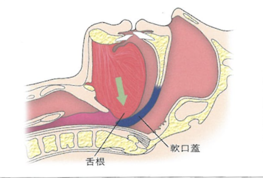 国立　歯医者　睡眠時無呼吸症候群