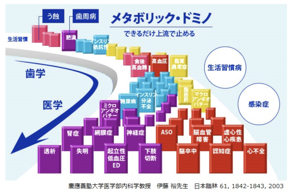 国立　歯医者　メタボリックドミノ