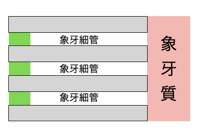 国立　歯医者　知覚過敏