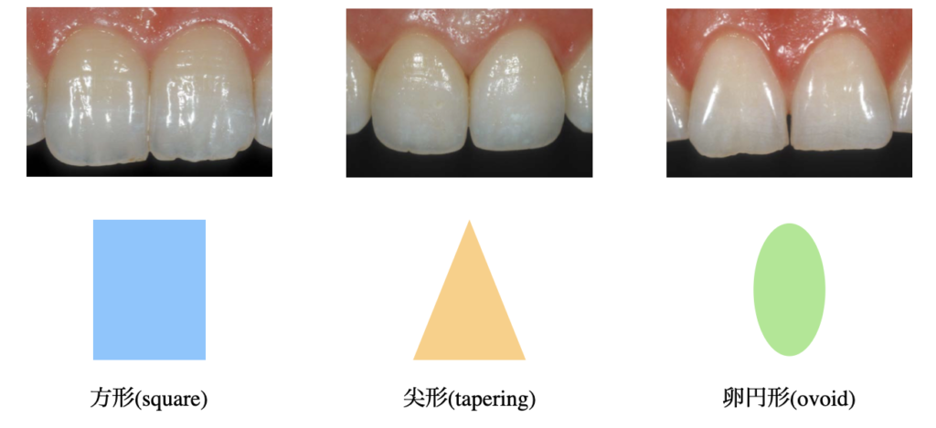 国立　歯医者　歯牙形態