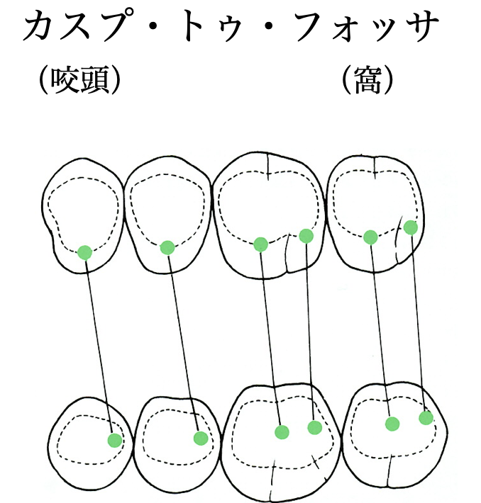 国立　歯医者　咬合