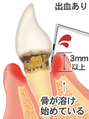 国立　歯医者　BOP