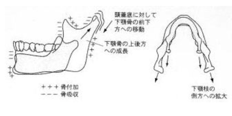 国立　歯医者　成長