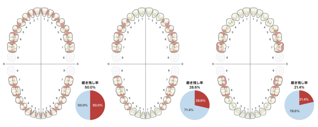 国立　歯医者　PCR