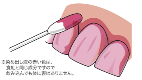 国立　歯医者　PCR