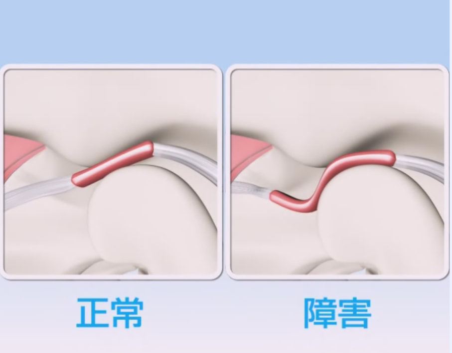 国立　歯医者　咬合性外傷