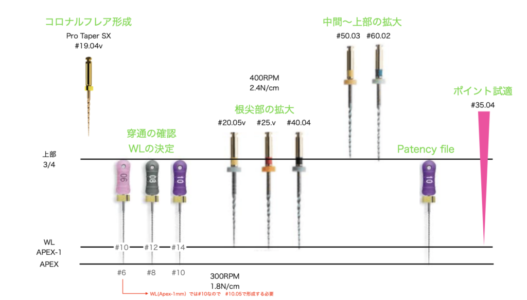 国立　歯医者　根管治療