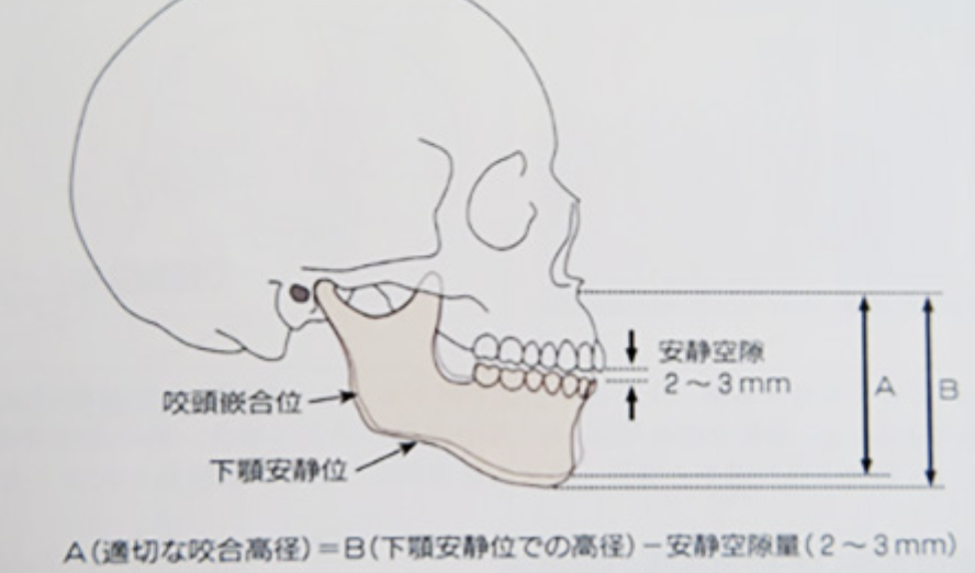 国立　歯医者　咬合