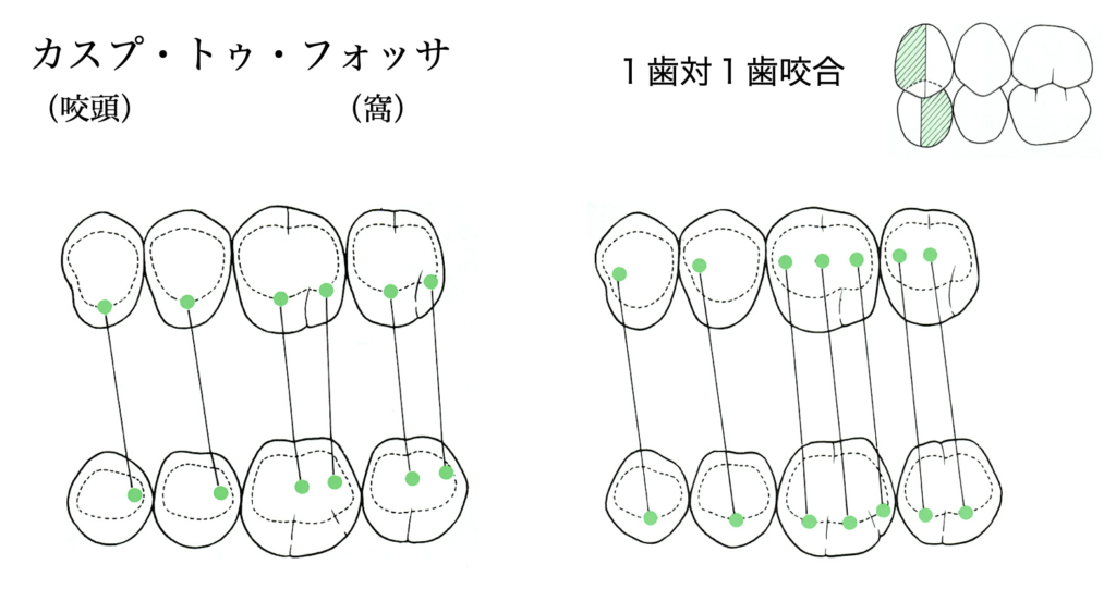 国立　歯医者　咬合