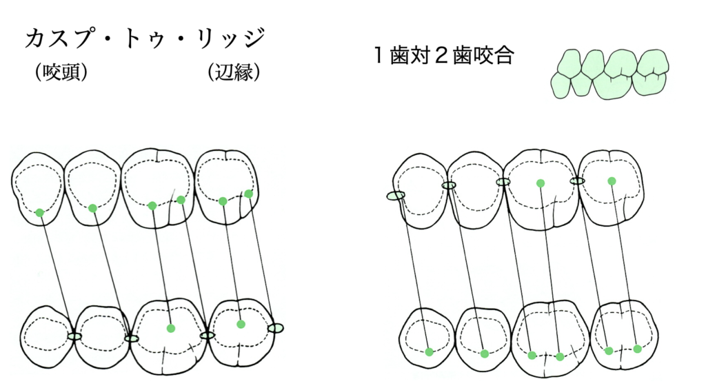 国立　歯医者　咬合
