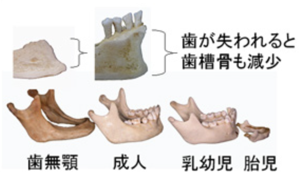 国立　歯医者　加齢変化