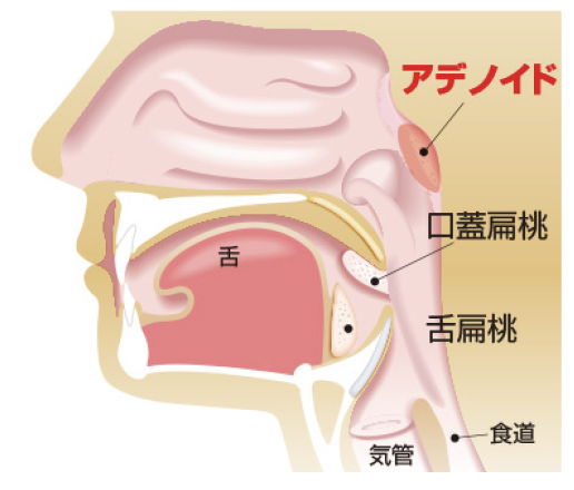 国立　歯医者　MFT