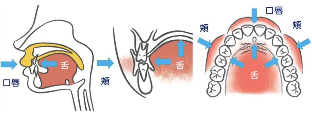 国立　歯医者　MFT