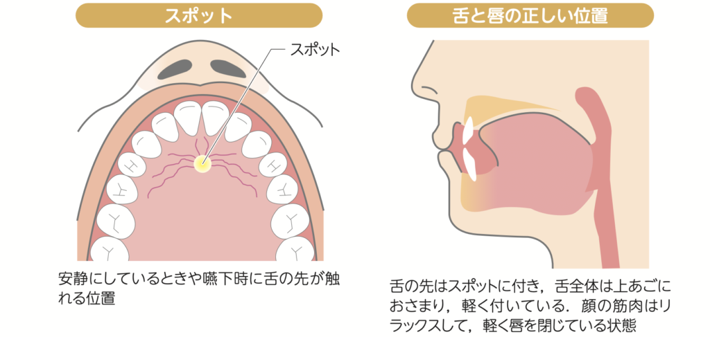 国立　歯医者　MFT