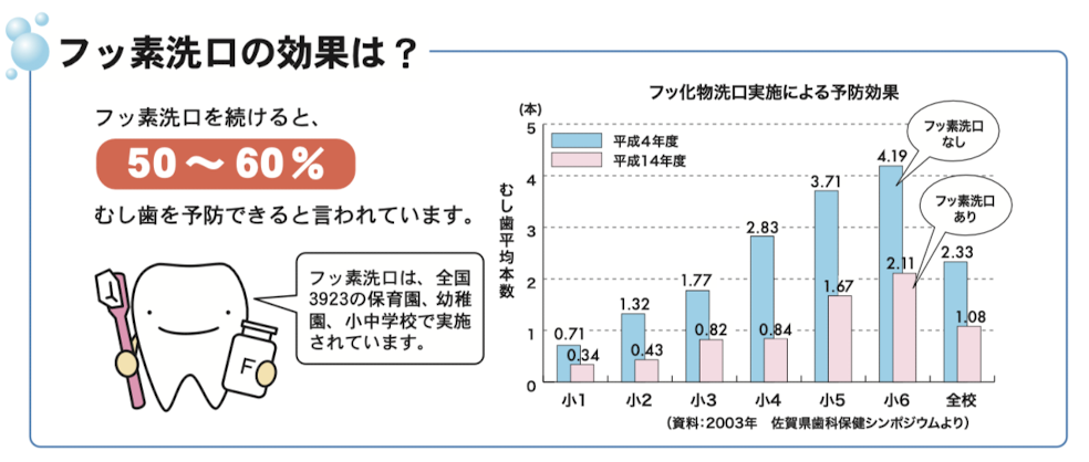 国立　歯医者　フッ素