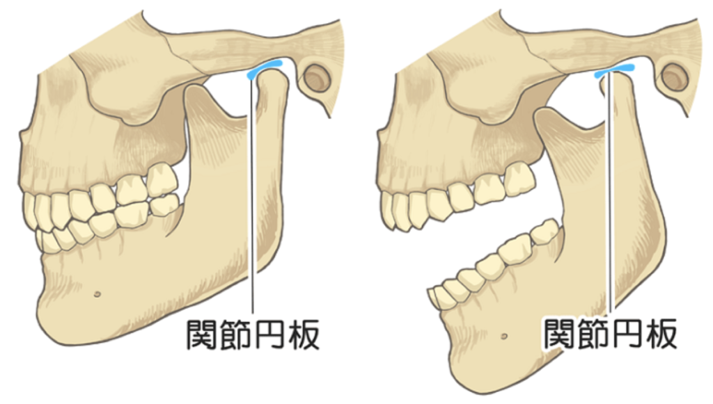 国立　歯医者　顎関節