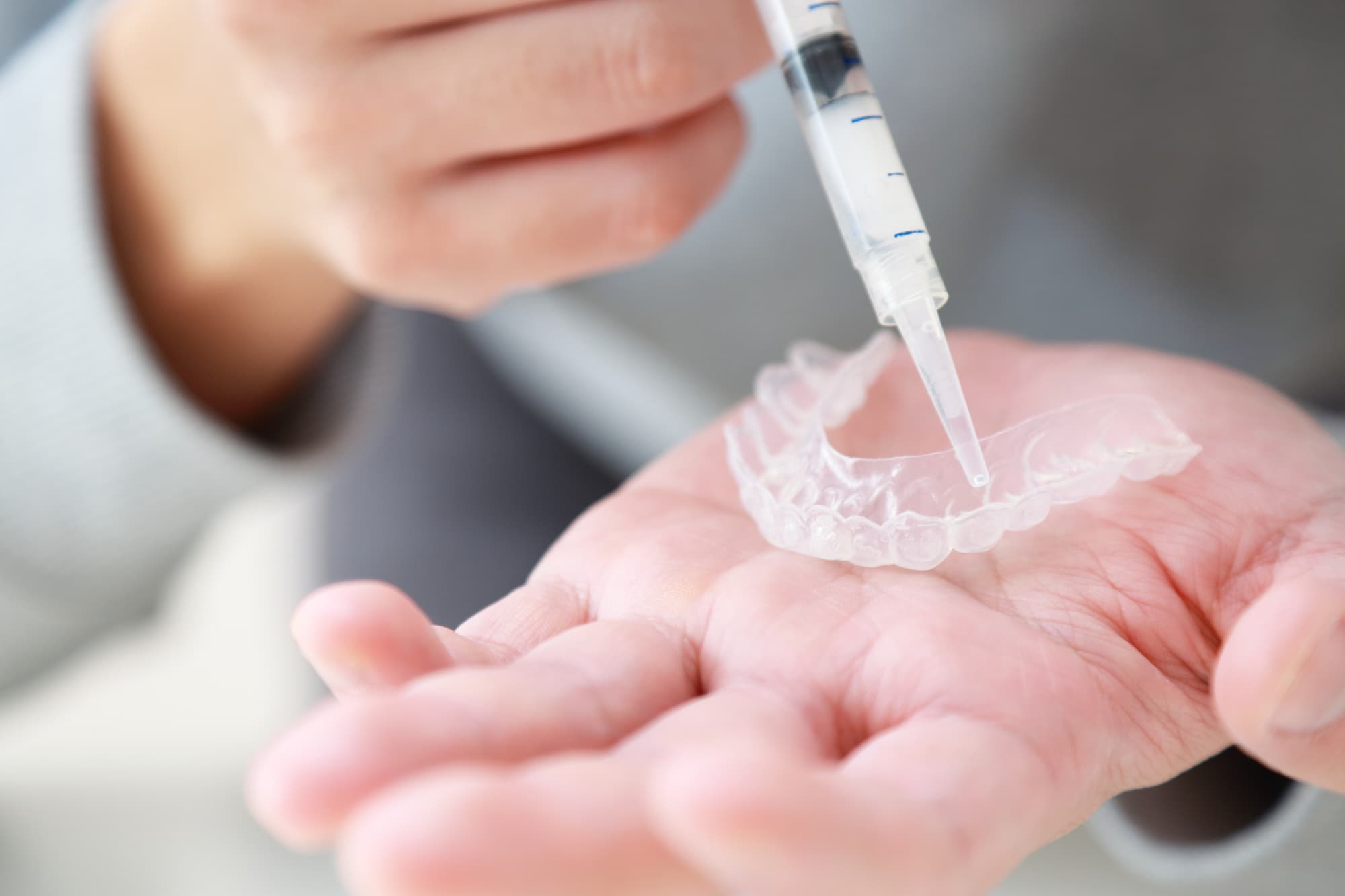 ホームホワイトニングのマウスピースに薬剤を注入する男性の手元